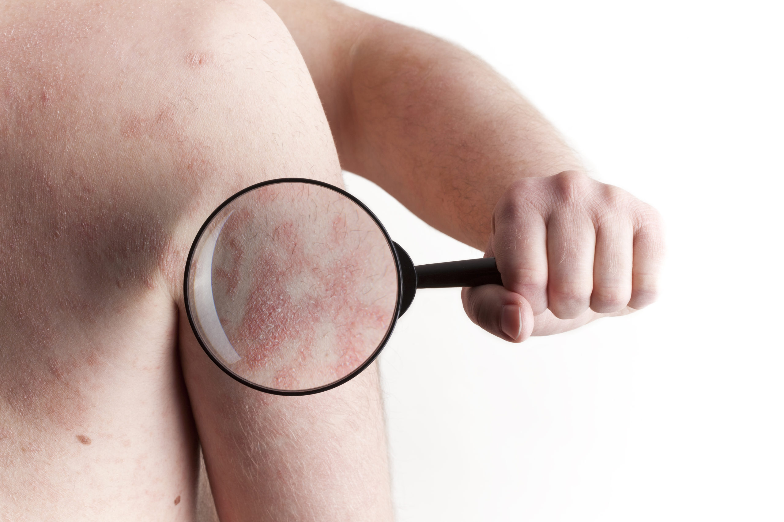 Rash Diagnosis & Treatment