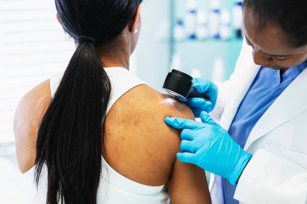 Basal Cell Carcinoma Treatment