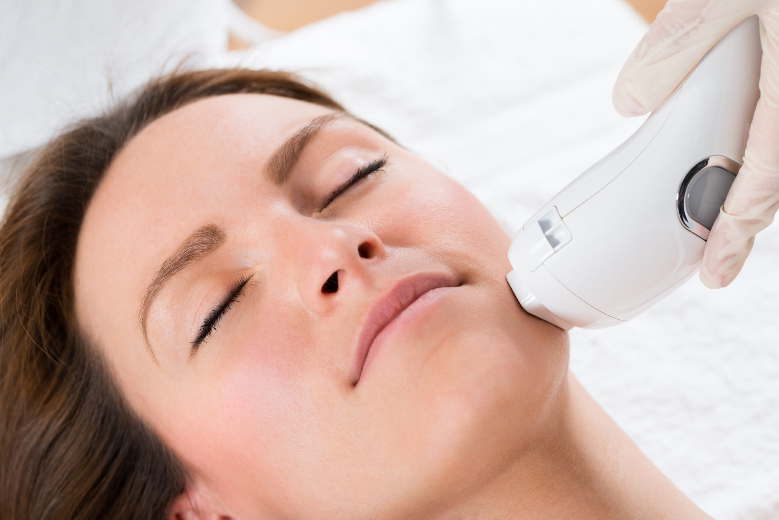 CO2 Laser Skin Resurfacing