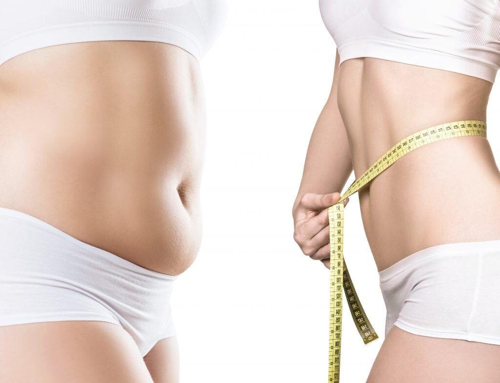 CoolSculpting